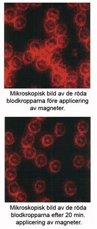 Röda blodkroppar